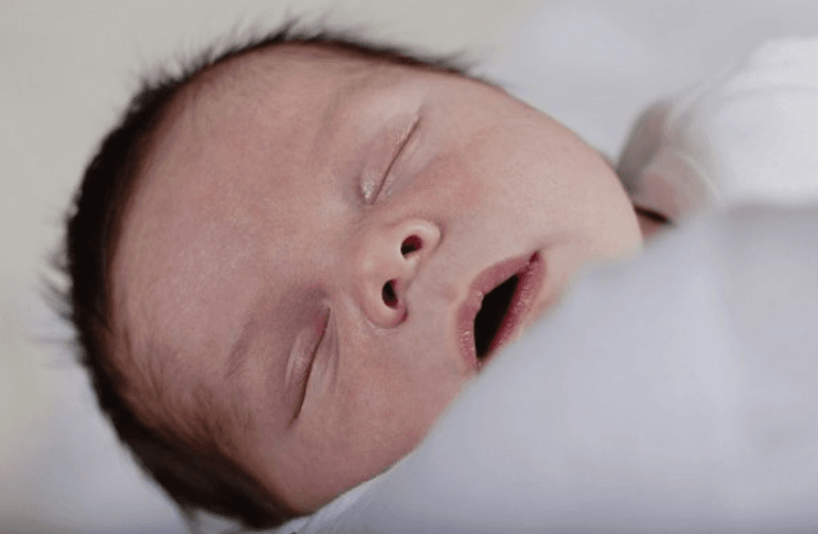 môi nhợt nhạt ở trẻ em