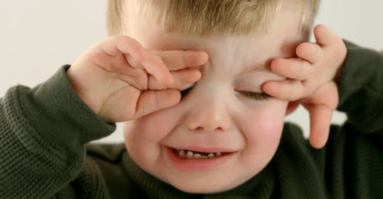 liệt dây thần kinh số 7 ở trẻ em