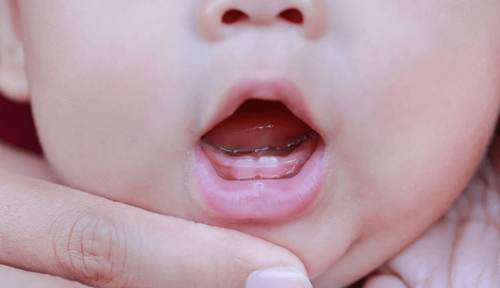 Khi nào cần đưa trẻ đi khám bác sĩ?