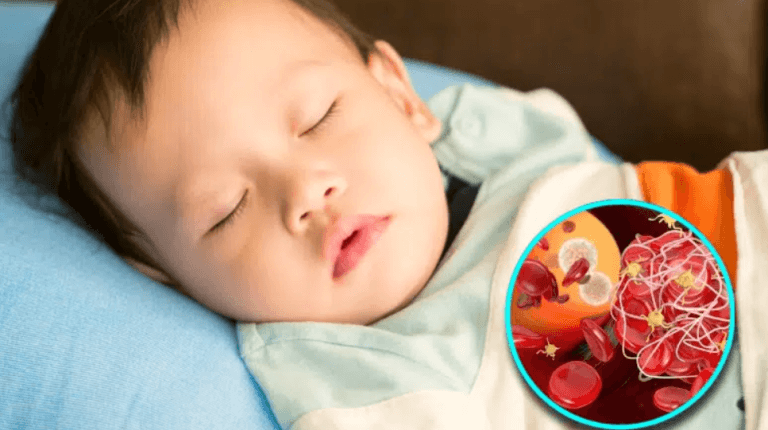 thiếu máu thiếu sắt ở trẻ em